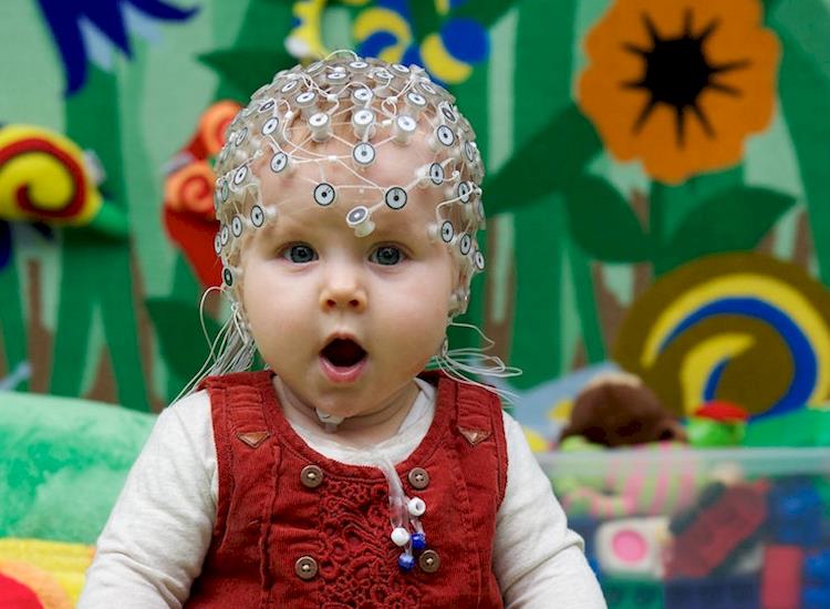 Electrodes on the head